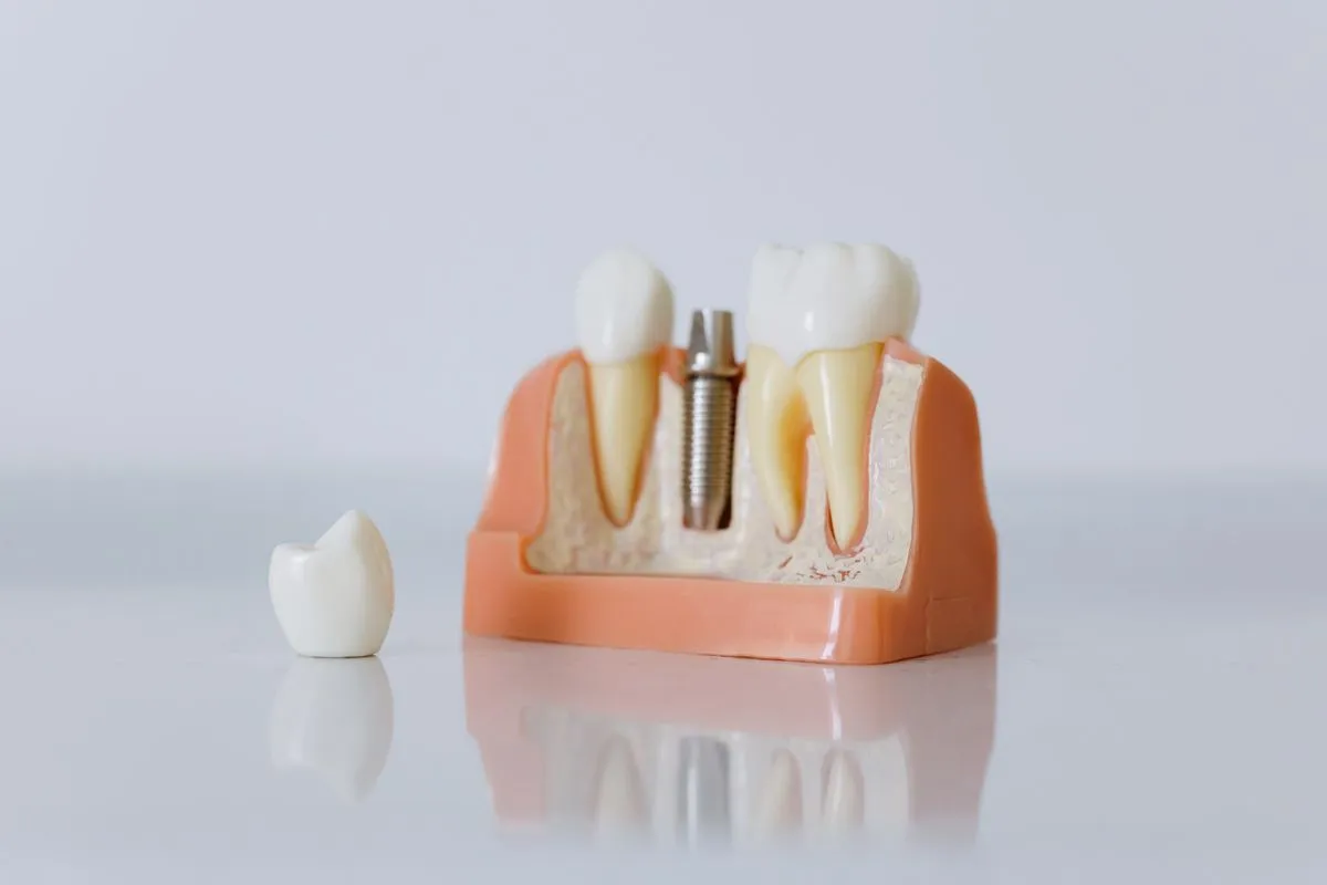Doctor reviewing a dental implant treatment plan with a patient in a modern clinic