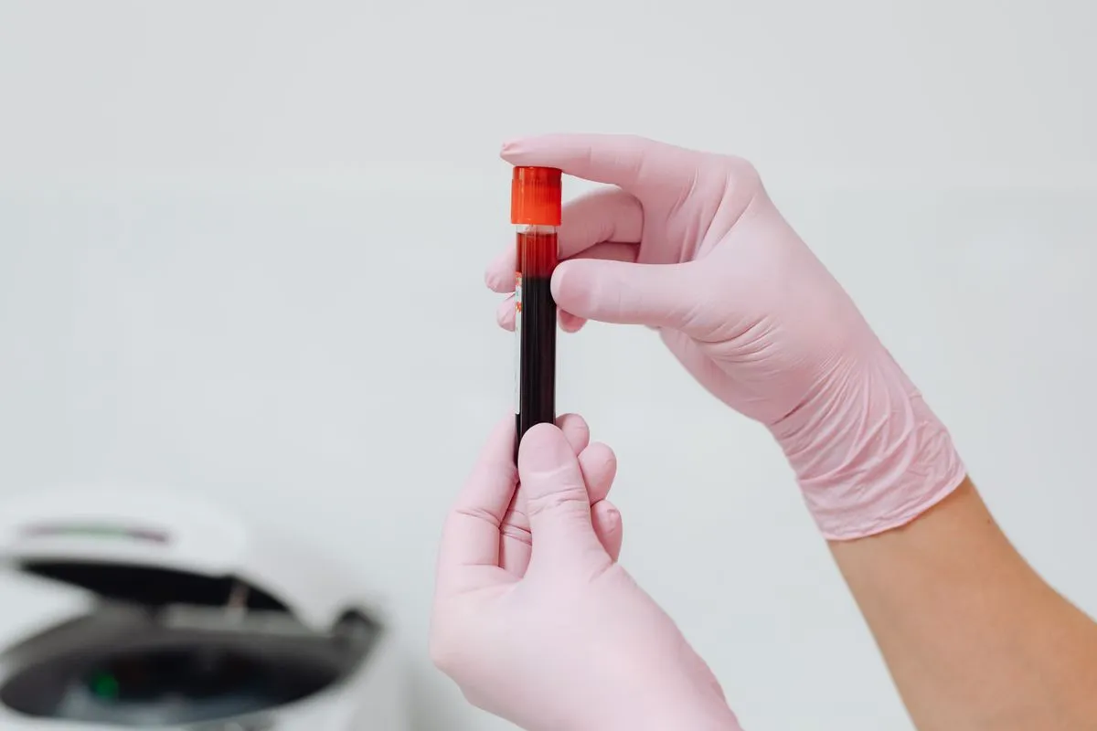 Profissional realizando exames de sangue com resultado online